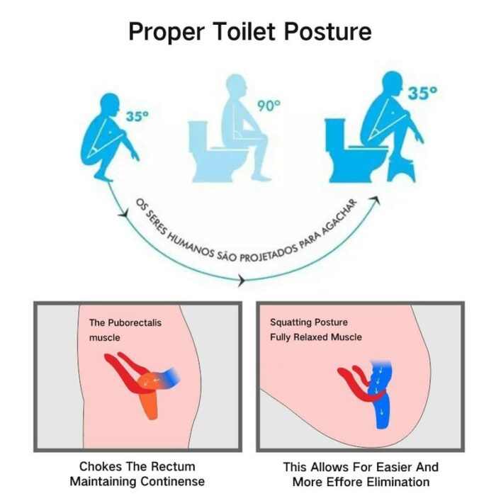 Folding Squatting Toilet Stool - Squatting Toilet Stool, Bathroom Toilet Stool, Potty Step Stool, Kids Comfortable Squat Aid Stool with Aromather